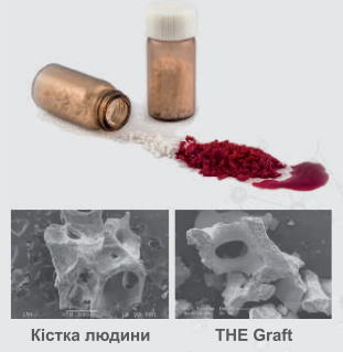 Кістковий матеріал Purgo THE Graft (1.8 см&sup3;) крупна фракція 0.5 g  BG-B05 фото